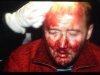 Акции протеста_Киев_избитые журналисты