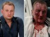 В Ивано-Франковске избили и ограбили депутата областного совета