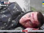 На Youtube появилось видео с украинским военным, на которого было совершено нападение