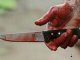 В Запорожье в парке нашли женщину с резаной раной шеи и ножевым ранением брюшной полости