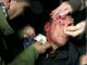Милиция отрицает свою причастность к избиению Луценко